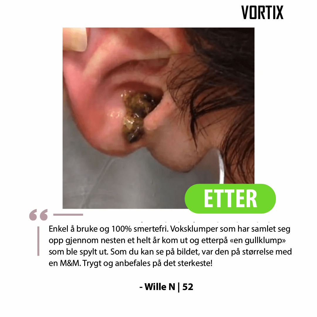 VORTIX – Kit Électrique de Nettoyage des Oreilles