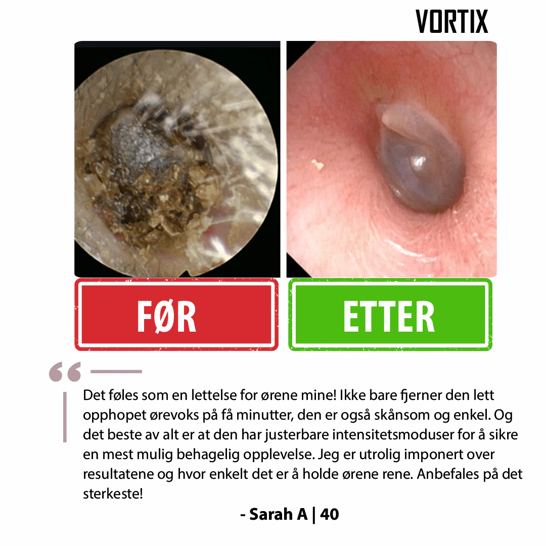 VORTIX – Kit Électrique de Nettoyage des Oreilles